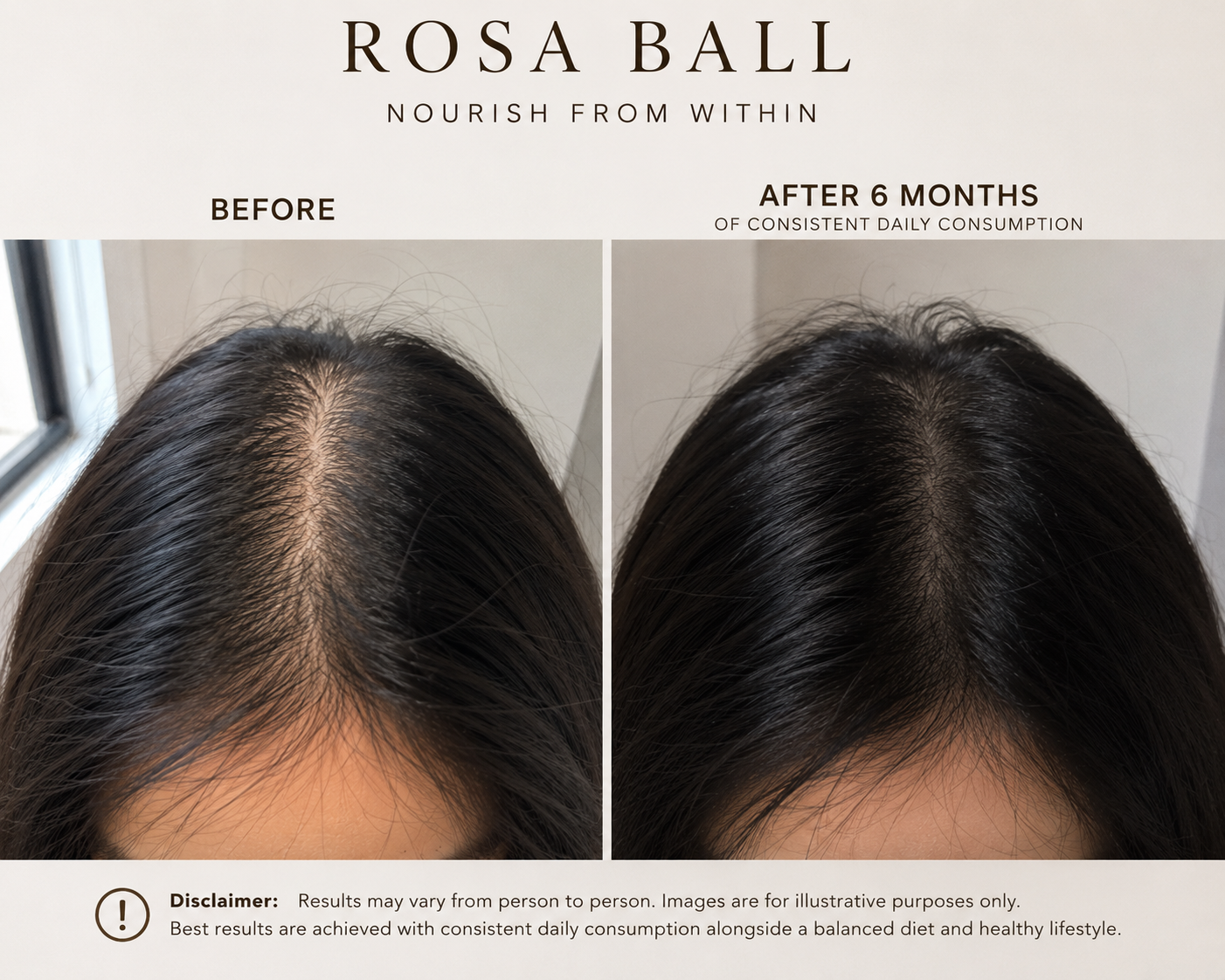 Rosa Balls (Healthy Hair Support) - PREORDER ETA MID JULY